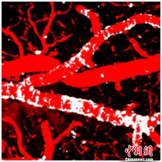 中國(guó)科學(xué)家揭示延緩阿爾茨海默病發(fā)病的新機(jī)制-肽度TIMEDOO