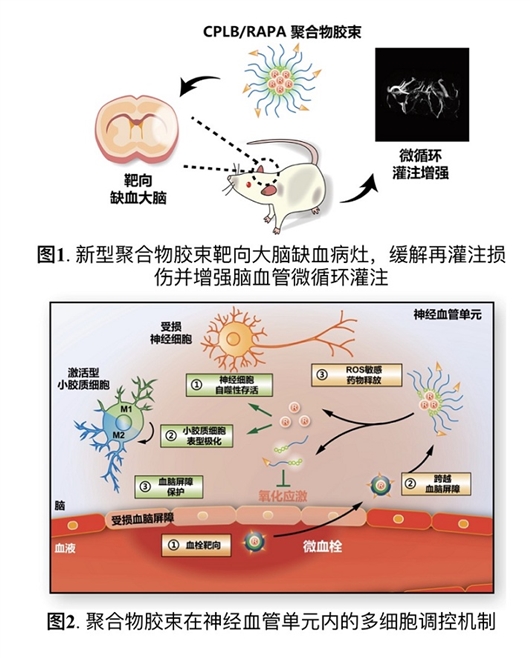 科學(xué)家構(gòu)建靶向治療缺血型腦卒中膠束遞藥系統(tǒng)-肽度TIMEDOO