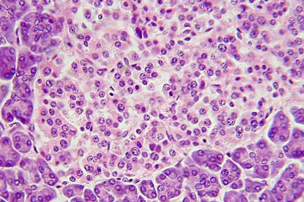 Nature Metabolism:皮下移植胰島細(xì)胞治療糖尿病-肽度TIMEDOO