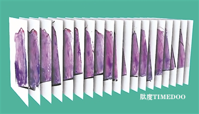 新平臺(tái)可繪制亞細(xì)胞精度的組織3D圖-肽度TIMEDOO
