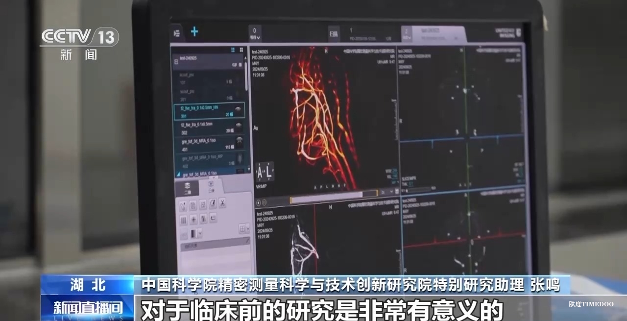 中國科學(xué)院團(tuán)隊(duì)成功突破“多核”磁共振成像技術(shù)-肽度TIMEDOO